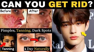 These Common Skin Problems Completely Destroy Your Looks Easy amp Effective Solutions [upl. by Dunn]