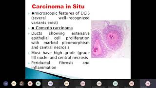 morphological types of breast cancer [upl. by Curran]