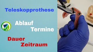 Die Teleskopprothese  Ablauf Termine Dauer und Zeitraum [upl. by Natal207]