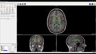 Analyze 150  Segment Adjust Regions [upl. by Bertrand]