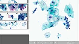 Digital Cytology Education Website [upl. by Jens]