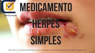 Medicamento de escolha para o Herpes Simples [upl. by Harriott923]