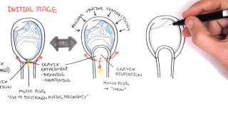 Obstetrics  Stage I of Labour [upl. by Thorncombe]