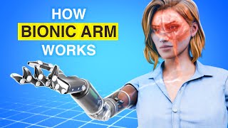 How Bionic Arm Works  3D Animation [upl. by Goss209]