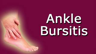 Ankle Bursitis [upl. by Solahcin]