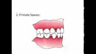 SelfCorrecting Malocclusions [upl. by Krenn]