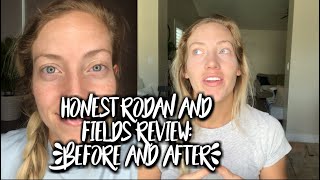 My Honest Rodan and Fields Skincare Review [upl. by Niltiac538]