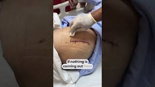 How to do surgical dressing at home like a DOCTOR  wounddressing totalhipreplacementsurgery [upl. by Jacobo349]