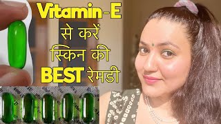 SKIN CHALLENGE इस तरह करें Vitamin E Oil का प्रयोग और पाए गोरी निखरी Healthy स्किन हमेशा के लिए [upl. by Dominy]