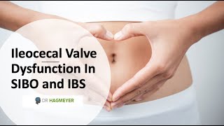 Healing The Ileocecal Valve amp Why Its Important In SIBOIBS [upl. by Eihtak]