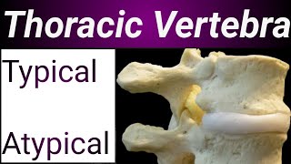 Anatomy of Thoracic Vertebrae Typical amp Atypical Thoracic Vertebrae Dr Shayzee [upl. by Leahcimnoj510]