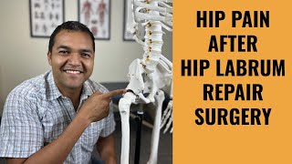 Top 5 Reasons For Hip Pain After A Hip Labrum Repair Surgery [upl. by Aynotan]