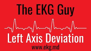 Left Axis Deviation on EKG  ECG l The EKG Guy  wwwekgmd [upl. by Sholom615]