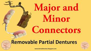 MCQs in Prosthodontics  Major and Minor Connectors  RPDs [upl. by Odette]