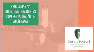 Odontometria com localizador apical em dente com grande restauração de amálgama [upl. by Guttery807]