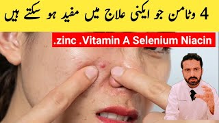 Top 4 Vitamins for Quick Acne Treatment Acne Vulgaris [upl. by Tomaso]