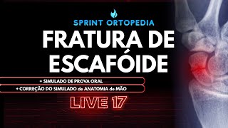 LIVE 17 FRATURA DE ESCAFÓIDE [upl. by Htieh]