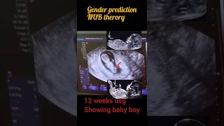 12weeks Ultrasound of baby boygender prediction nub theory shortsfeed reels [upl. by Malamud]