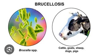 Mystery diagnosis Brucellosis [upl. by Hylan30]