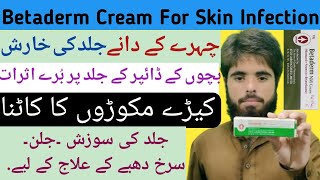 Betaderm N Cream  Neomycine  Betamehasone  Treatment Of Skin Infecions EczemaRashesDermatitis [upl. by Nevanod]