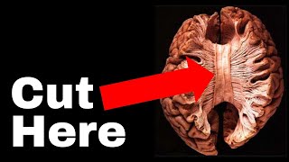 The Unsettling Truth about Human Consciousness  The Split Brain experiment that broke neuroscience [upl. by Adirehs844]