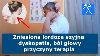 Spłycona zniesiona lordoza szyjna  Przepuklina szyjna  Dyskopatia  Objawy ćwiczenia 🇵🇱 🇪🇺 [upl. by Aillemac712]