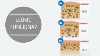 LIPOCELLCRIO Criolipólisis por Starbene [upl. by Airtemak388]