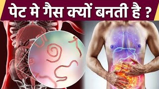 Gas ki problem kaise cure karen  gas ki samasiya kaise theek karen  cipzer ayurvedic [upl. by Secnirp362]