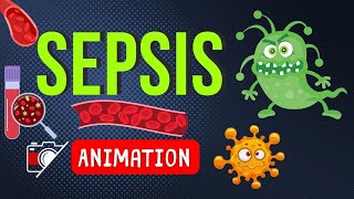 🦠 SEPSIS ANIMATION  🎬 FUNNY MEMORABLE MNEMONIC [upl. by Aerda]