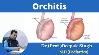 Orchitis  Inflammation of testis  Deepak PD Singh [upl. by Daugherty]