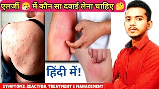 Allergy in hindi  एलर्जी में use होने वाले दवाई 😱  symptoms types  antiallergic medicine [upl. by Ydnys307]