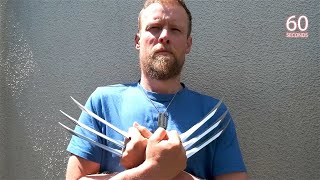 Meet The Irish Man Who Got Wolverine Claw Implants In Turkey [upl. by Assilev]