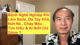 Bệnh Nghề Nghiệp Khi Làm Nails  Da Tay Khô  Nứt Nẻ  Chảy Máu  Tìm Hiểu amp Ai Biết Chỉ Giùm [upl. by Akived]