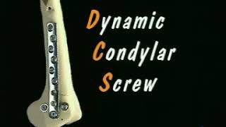 DCS Dynamic Condylar Screw for Distal femur Surgical Technique [upl. by Bryce]