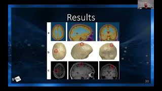 How to record EEG with 1024 channels with gPANGOLIN ultra highdensity EEG system [upl. by Gredel274]