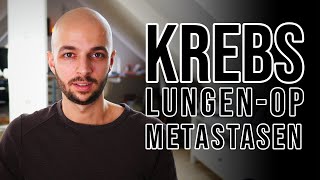 Chemoblog  OP meiner Lungenmetastasen [upl. by Leba]