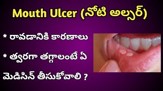 Mouth Ulcers Reasons and Treatment in Telugu [upl. by Ylurt]