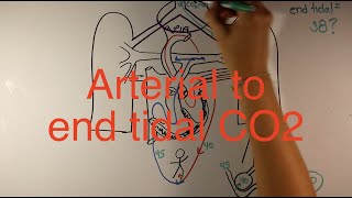 End tidal to arterial CO2 difference in CHD [upl. by Neyut16]