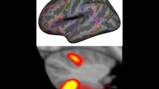 BuckneretalJNeurophysiology2011Topographyavi [upl. by Griffy993]