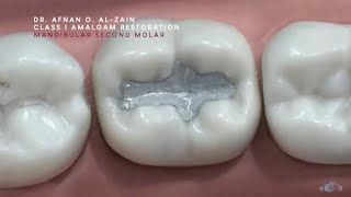 Class I amalgam restoration – Mandibular molar 47  Arabic عربي [upl. by Bricker914]