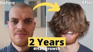 💇🏻💈Hair Growth Time Lapse 2 Years 24 Months Men  From Buzz Cut [upl. by Justina513]