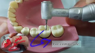 شرح تفصيلى خطوه بخطوه class 1 cavity preparation والأخطاء اللى ممكن تحصل وازاى نحلها [upl. by Klute540]