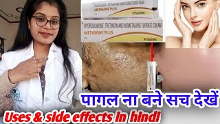 Metasone plus cream honest review Metasone plus cream benefits Uses amp side effects in hindi [upl. by Lein]