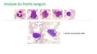 Les outils diagnostics en hématologie [upl. by Sosna365]