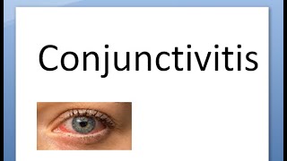 Ophthalmology 070 a Conjunctivitis What is Types Infection Allergic Classification Eye Cause Red [upl. by Concordia]