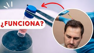 CÉLULAS MADRE para el cabello 💉🩸ALOPECIA [upl. by Noyart]