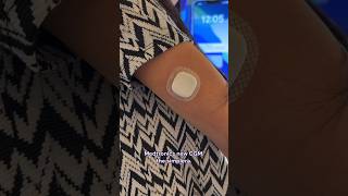 Testing the Medtronic Simplera CGM t1d diabetes [upl. by Lossa]