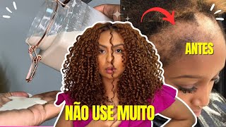 O CABELO CRESCE EM 10 DIAS COM APENAS 2 INGREDIENTES COMBATE A QUEDA CAPILAR [upl. by Assiar]