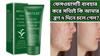 Breylee Acne Treatment Facial Cleanser Review  Breylee Acne Treatment Facewash  Breylee Facewash [upl. by Niwde]