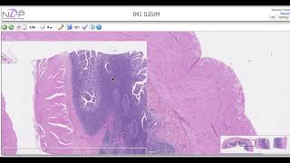 Histological description of the Ileum Peyers patches [upl. by Olodort646]